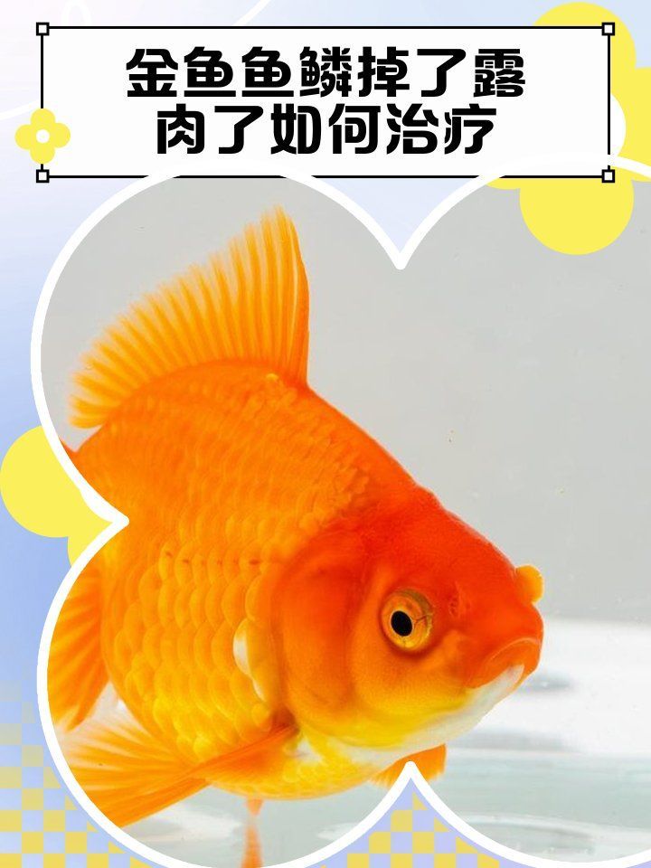 松鱗病能否完全治愈，人類的魚鱗病有哪些類型哪種藥物治療松鱗病最有效