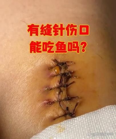 手術切除肉球后如何護理龍魚?,手術切除龍魚肉球后潰爛、脂肪瘤或增生組織護理需求 龍魚百科 第2張 手術切除肉球后如何護理龍魚?,手術切除龍魚肉球后潰爛、脂肪瘤或增生組織護理需求 手術切除肉球后如何護理龍魚?,手術切除龍魚肉球后潰爛、脂肪瘤或增生組織護理需求 龍魚百科 第2張