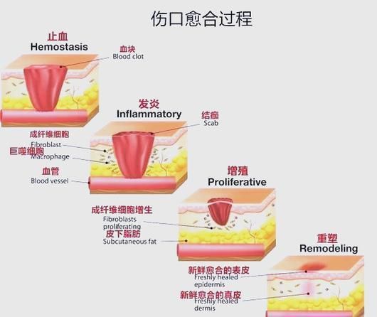如何預防海水細菌感染，海水病原體防控