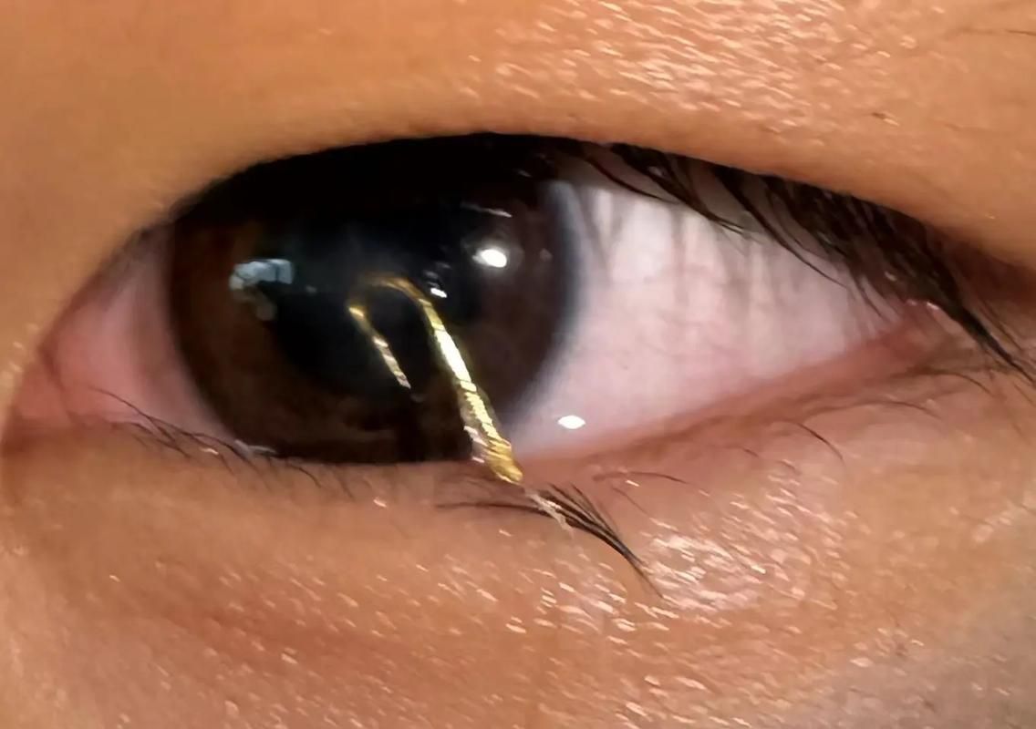 如何判斷魚蒙眼的嚴重程度，如何判斷魚蒙眼