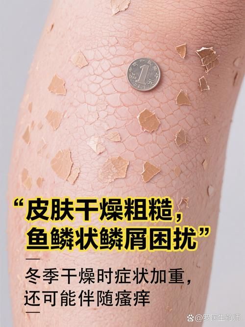 魚鱗皮膚病圖片，如何區分不同類型的魚鱗?。?></span><br><span id=