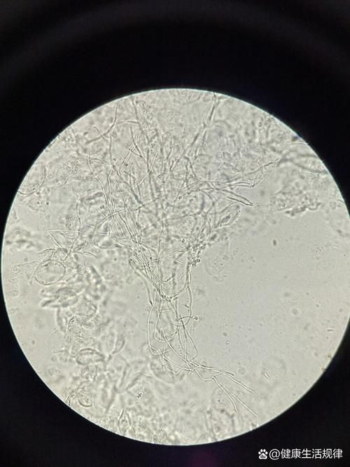 如何判斷銀龍魚潰爛是否繼發水霉菌感染，如何判斷銀龍魚是否潰爛