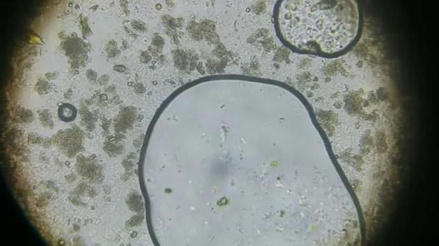 如何判斷銀龍魚潰爛是否繼發水霉菌感染，如何判斷銀龍魚是否潰爛