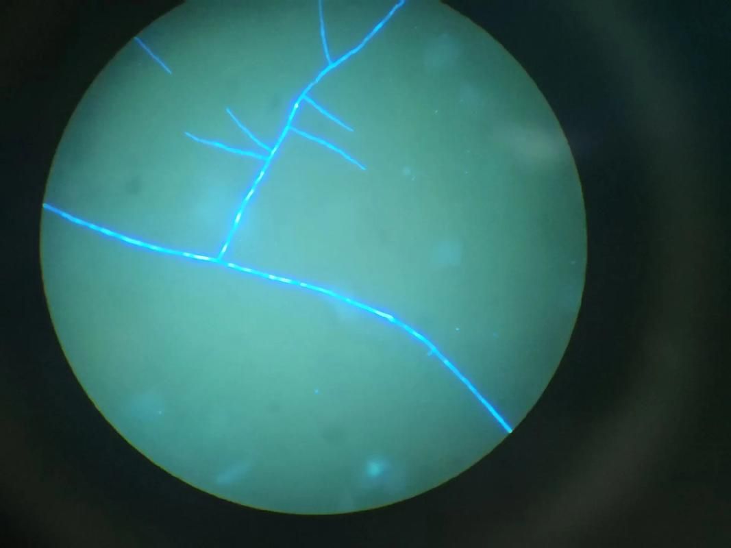 如何判斷銀龍魚潰爛是否繼發水霉菌感染，如何判斷銀龍魚是否潰爛