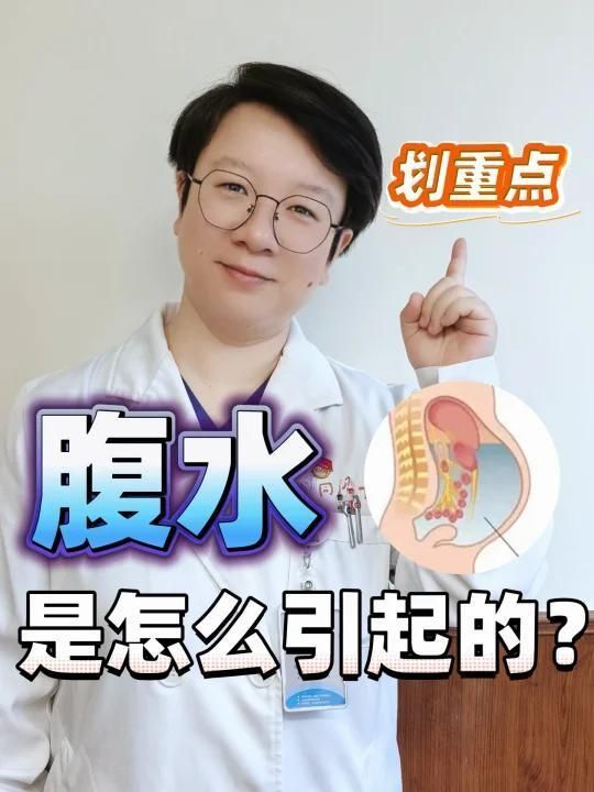 如何區分不同病因的腹水，治療腹水的常見病因及腹水病因及腹水病因及其特點