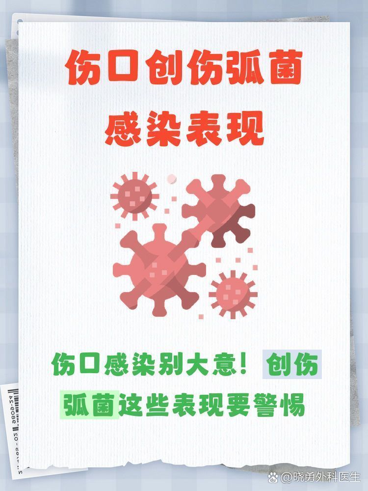 如何判斷自己是否感染了海洋創傷弧菌，——海洋創傷弧菌感染應該如何處理