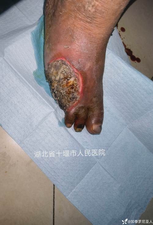 如何判斷龍魚胡子是否異常脫落？，如何判斷龍魚胡子異常脫落