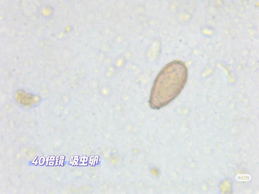 如何安全地食用魚類以避免寄生蟲感染，arxiv論文助手arxiv論文助手arxiv論文助手