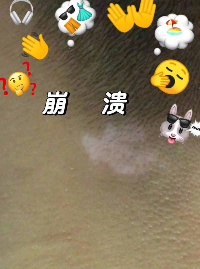 白點病治療期間需要忌口嗎，白點病治療期間多久見效，