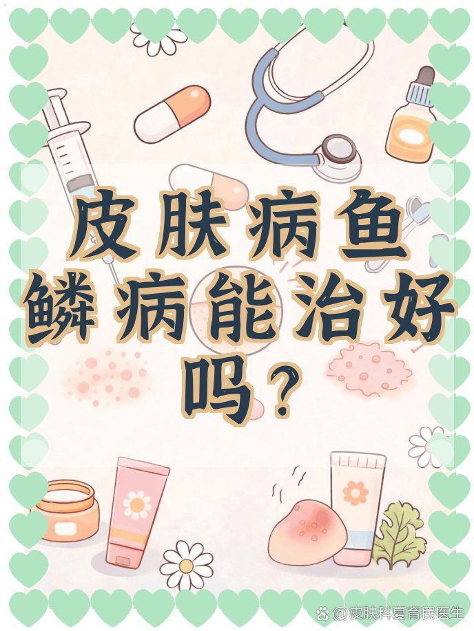魚鱗皮膚病如何治療，治療魚鱗病的方法