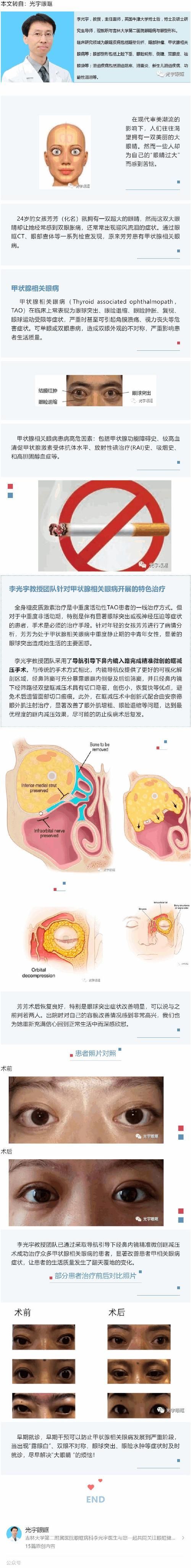 哪些飼料有助于預防突眼病，斗魚突眼病的飼料預防機制詳解（exophthalmos）