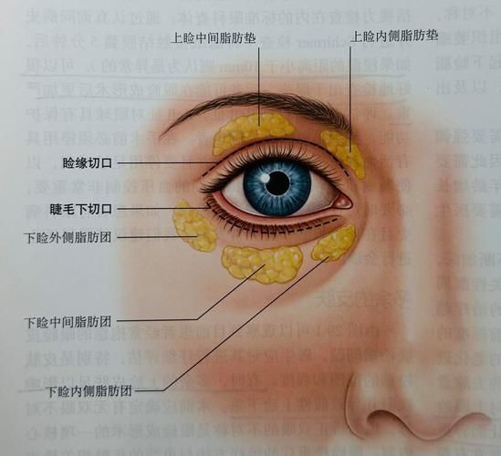 有哪些藥物可以幫助治療魚(yú)突眼，“魚(yú)突眼”的藥物治療