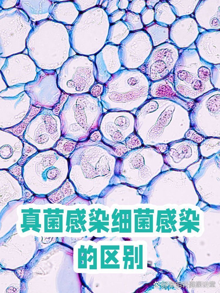 真菌感染和細菌感染如何區分，張明軒健康講堂張明軒健康講堂張明軒健康講堂張明軒 真菌感染和細菌感染如何區分，張明軒健康講堂張明軒健康講堂張明軒健康講堂張明軒 龍魚百科 第1張