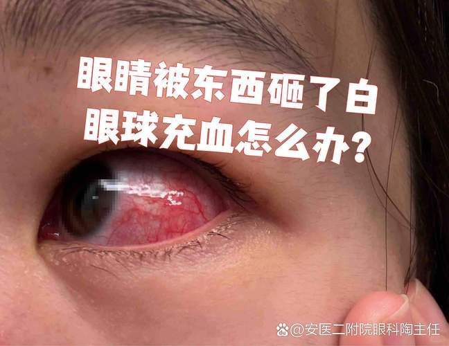 魚頭充血多久會好，“魚頭充血多久會好”