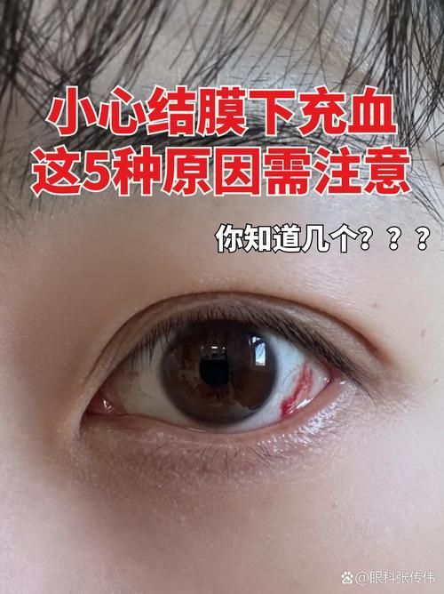 魚頭充血多久會好，“魚頭充血多久會好”