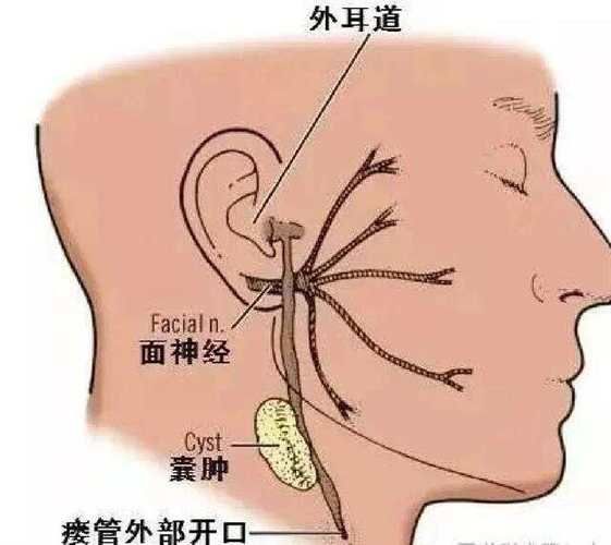 翻鰓手術(shù)風(fēng)險(xiǎn)大嗎，百度健康-去問診,