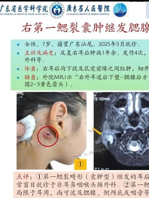 翻鰓手術(shù)風(fēng)險(xiǎn)大嗎，百度健康-去問診,
