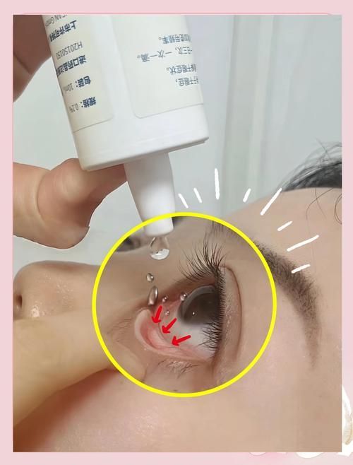 如何預防魚蒙眼病的復發，魚蒙眼病復發預防