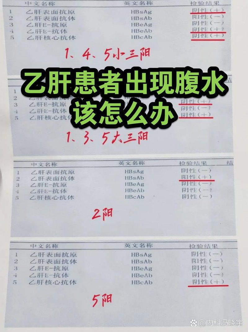 病毒性感染引起的腹水病如何治療，內科馮曉宇，有哪些病毒性感染會導致腹水