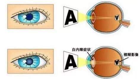 如何區分龍魚眼球的白點是病還是其他原因？，如何判斷龍魚眼球上的白點是病還是其他原因