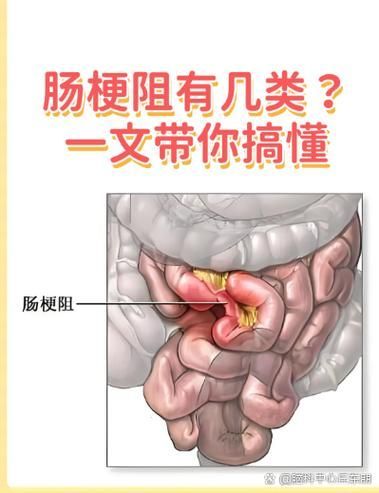 腸梗阻對龍魚有哪些影響，腸梗阻對龍魚的影響