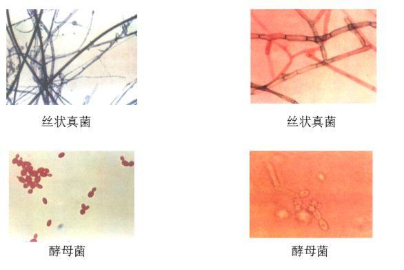 真菌和細(xì)菌感染的治療方法有哪些