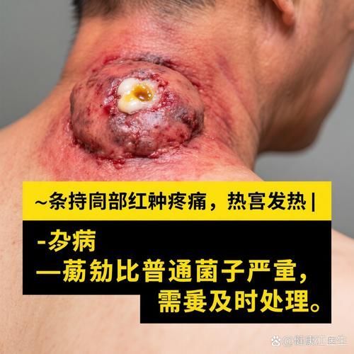 真菌和細(xì)菌感染的治療方法有哪些