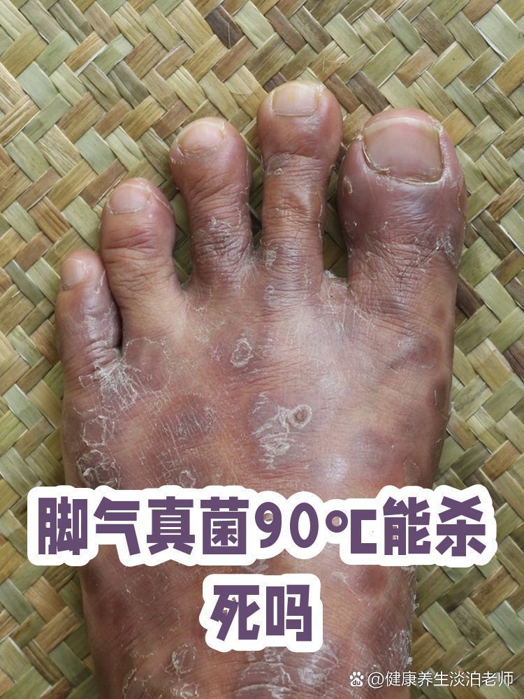 高溫消殺真菌的具體溫度是多少，消殺真菌的具體溫度取決于所要消殺的具體溫度取決于所要消殺的真菌 高溫消殺真菌的具體溫度是多少，消殺真菌的具體溫度取決于所要消殺的具體溫度取決于所要消殺的真菌 龍魚百科 第1張