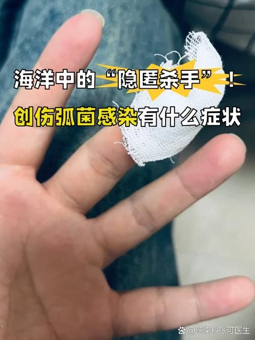 海洋弧菌感染早期圖片，感染海洋弧菌后多久會出現癥狀 海洋弧菌感染早期圖片，感染海洋弧菌后多久會出現癥狀 龍魚百科 第12張