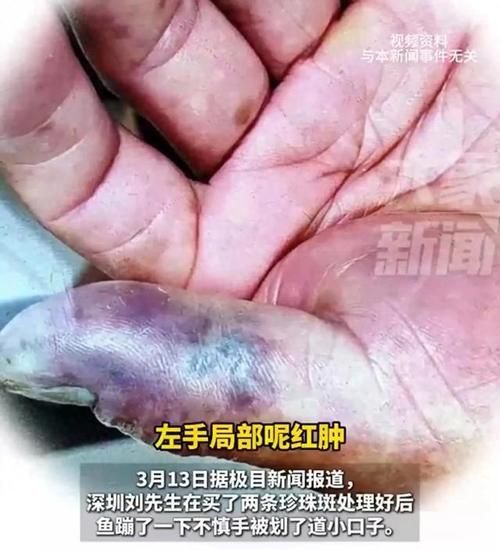 海洋弧菌感染早期圖片，感染海洋弧菌后多久會出現癥狀 海洋弧菌感染早期圖片，感染海洋弧菌后多久會出現癥狀 龍魚百科 第14張