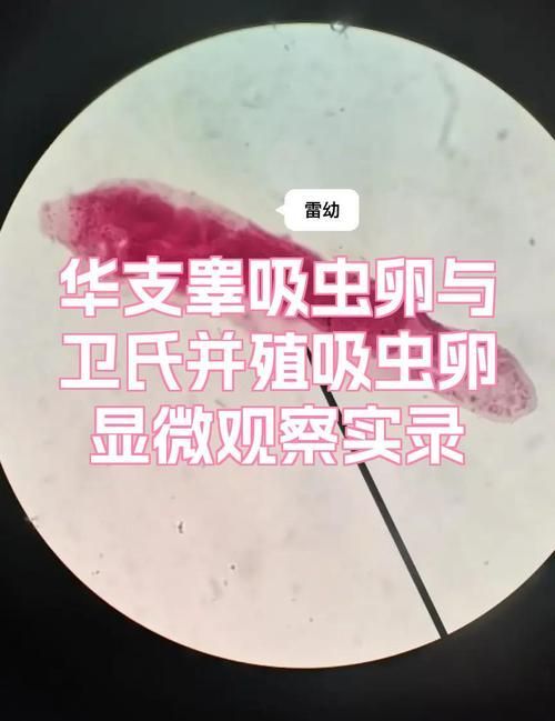 魚得寄生蟲怎么治療，arxiv論文助手（arxiv論文助手治療方案）