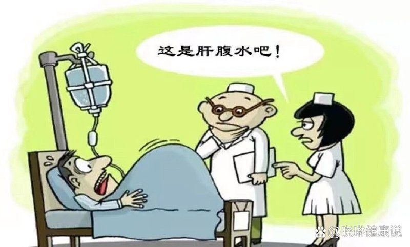 如何預防腹水再次生成