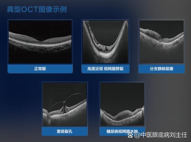 給我一份爛鰓病診斷對照表，———病原類型、癥狀對照表