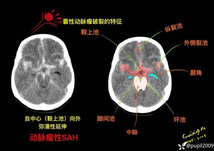 給我一份爛鰓病診斷對照表，———病原類型、癥狀對照表