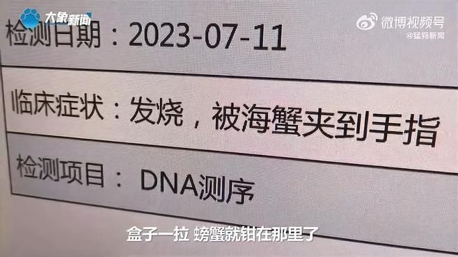 哪種海魚扎傷最容易感染，深圳多人被海魚扎傷后感染風(fēng)險(xiǎn)最高 哪種海魚扎傷最容易感染，深圳多人被海魚扎傷后感染風(fēng)險(xiǎn)最高 龍魚百科 第3張