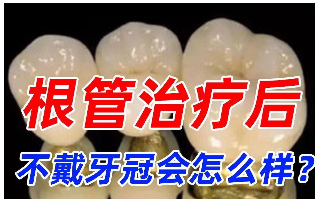 門牙根管治療后需要戴牙冠嗎，牙+牙治療后，是否需要戴牙冠