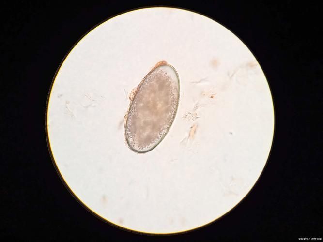如何預防魚虱子的傳播，如何防治魚虱子 如何預防魚虱子的傳播，如何防治魚虱子 龍魚百科 第5張