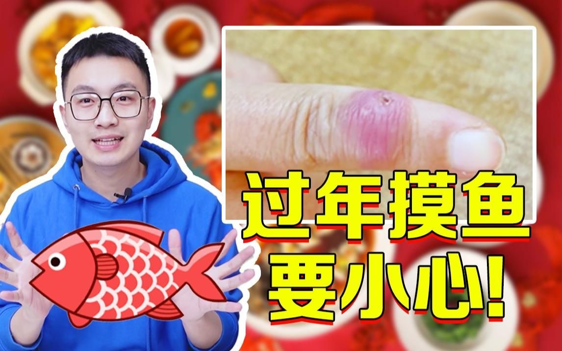 如何預防海魚扎傷感染，海魚扎傷怎么辦？ 如何預防海魚扎傷感染，海魚扎傷怎么辦？ 龍魚百科 第2張