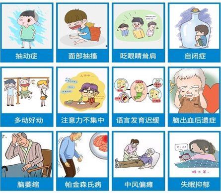 人工刺激療法成功率高嗎，人工刺激療法成功率高度依賴適應(yīng)癥、患者群體與治療參數(shù)