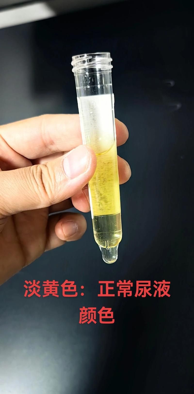 甲基藍有哪些副作用，甲基藍（亞甲基藍）副作用信息整理