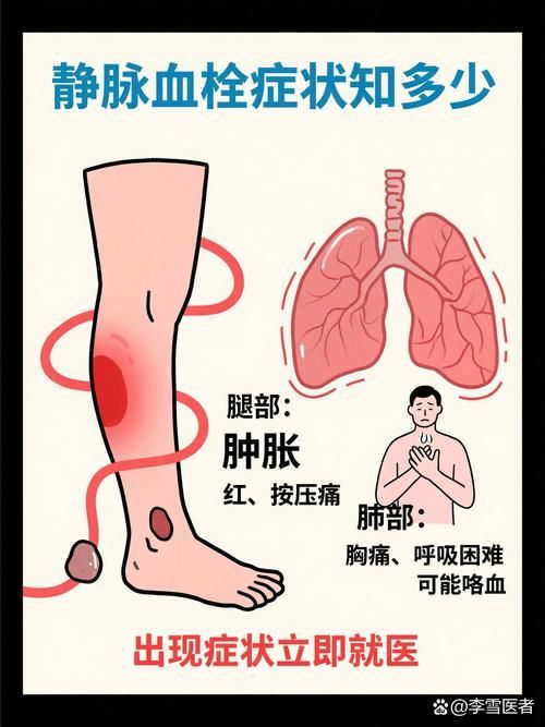 充血病有哪些治療方法，mcp工具“充血病”和“找醫生”可輔助獲取臨床治療建議