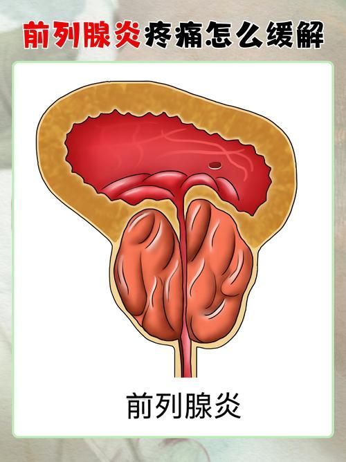 充血病有哪些治療方法，mcp工具“充血病”和“找醫生”可輔助獲取臨床治療建議