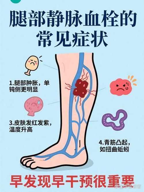 充血病有哪些治療方法，mcp工具“充血病”和“找醫生”可輔助獲取臨床治療建議