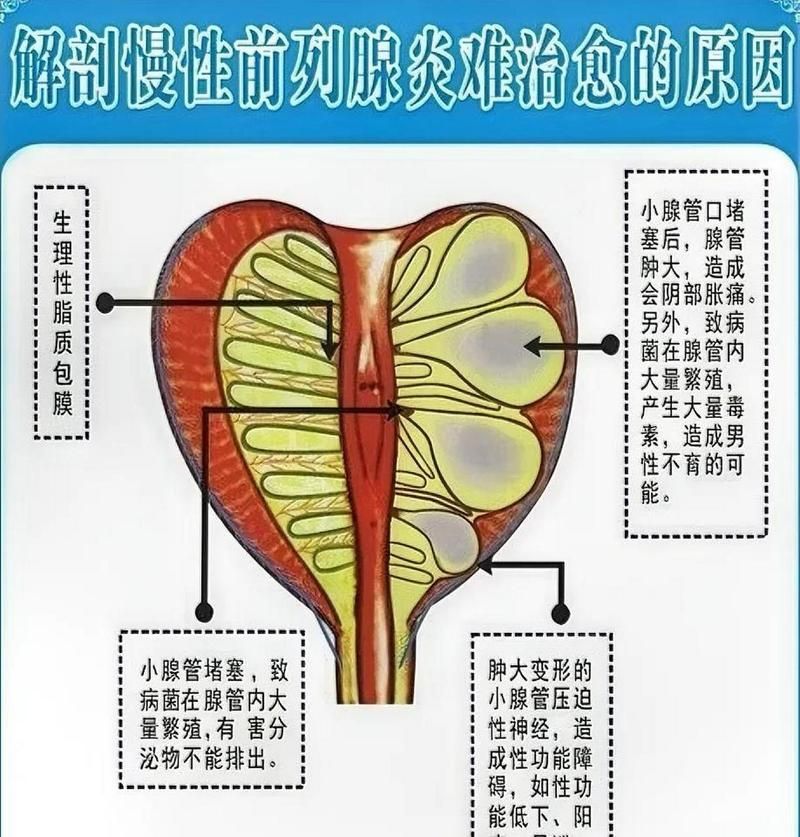 充血病有哪些治療方法，mcp工具“充血病”和“找醫生”可輔助獲取臨床治療建議