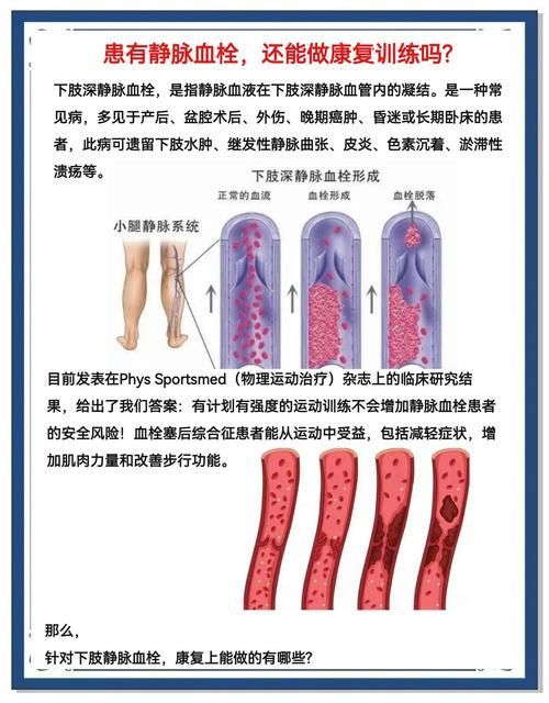 充血病有哪些治療方法，mcp工具“充血病”和“找醫生”可輔助獲取臨床治療建議