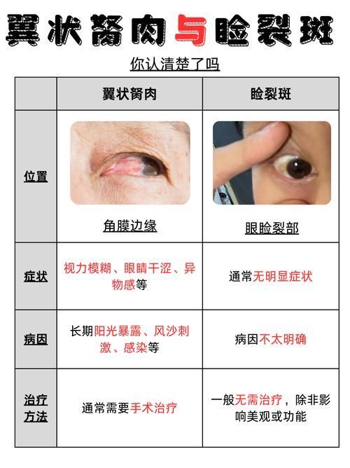 如何判斷魚眼白膜是否嚴重，如何判斷“魚眼白膜”是否嚴重