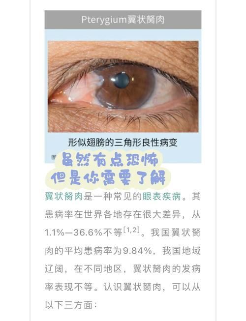 如何判斷魚眼白膜是否嚴重，如何判斷“魚眼白膜”是否嚴重