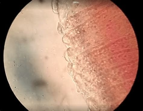 龍魚胸鰭抖動可能是哪些寄生蟲感染？，魚胸鰭抖動可能是由多種寄生蟲感染引起的