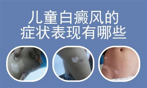 白點病是什么原因造成的，白點病是一種由真菌引起的植物病害引起的植物寄生蟲病 白點病是什么原因造成的，白點病是一種由真菌引起的植物病害引起的植物寄生蟲病 龍魚百科 第1張