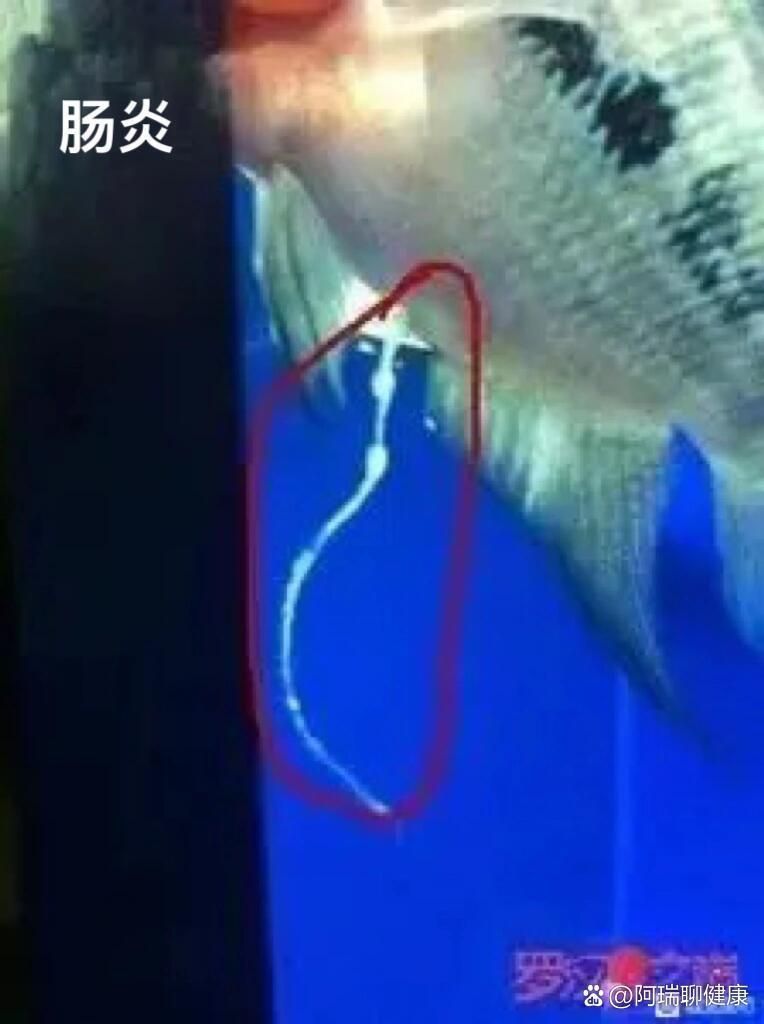 如何治療魚腸炎，如何治療魚腸炎（魚腸炎）